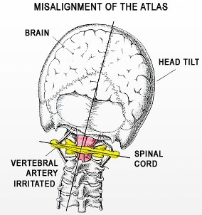 Metodo Atlas Orthogonal