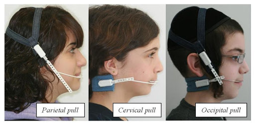 Trattamento cervicale